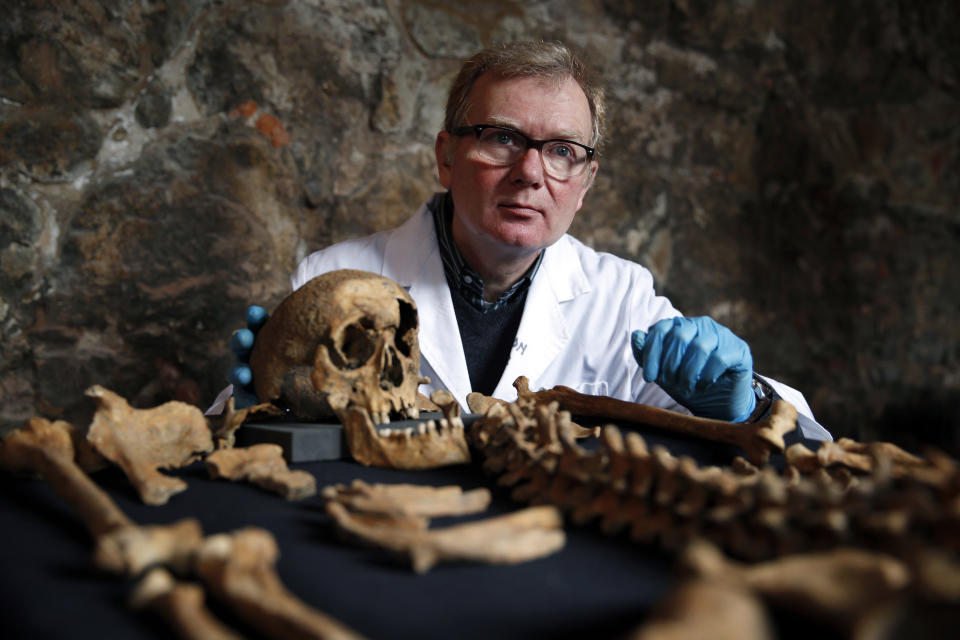 In this Wednesday, March 26, 2014 photo, Don Walker, a human osteologist with the Museum of London, poses for photographers, with one of the skeletons found by construction workers under central London's Charterhouse Square. Twenty-five skeletons were uncovered last year during work on Crossrail, a new rail line that's boring 13 miles (21 kilometers) of tunnels under the heart of the city. Archaeologists immediately suspected the bones came from a cemetery for victims of the bubonic plague that ravaged Europe in the 14th century. The Black Death, as the plague was called, is thought to have killed at least 75 million people, including more than half of Britain's population. (AP Photo/Lefteris Pitarakis)