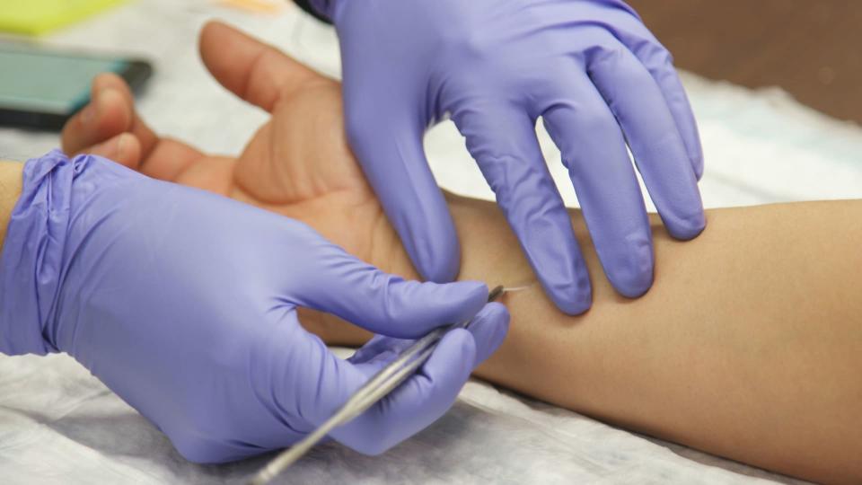 Mary Prunicki takes a skin sample from a firefighter to test for toxins. (NBC News)