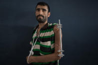 <p>IDP community center, Sana’a, Yemen, April 30, 2017: Majed Shoei was injured in Taizz six months ago when a bomb exploded near to him. He broke his arm and leg as a result. He now lives with his brother in Sana’a, having fled Taizz to escape the hostilities and to seek medical treatment. (Photograph by Giles Clarke for UN OCHA/Getty Images) </p>