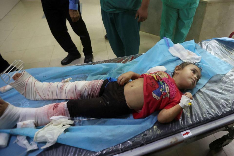PHOTO: A Palestinian girl, wounded in Israeli strikes, lies on a bed at a hospital in Khan Younis in the southern Gaza strip, Oct. 16, 2023. (Ahmed Zakot/Reuters)