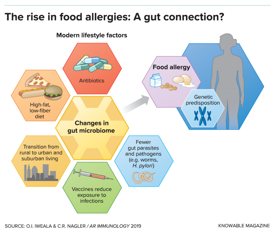 A graphic lays out aspects of the modern lifestyle that may disrupt the makeup of our microbiome and spur development of food allergies: diet, urban/suburban living, vaccines, antibiotics and exposure to fewer pathogens and parasites. Genetic predisposition will also affect allergy risk.