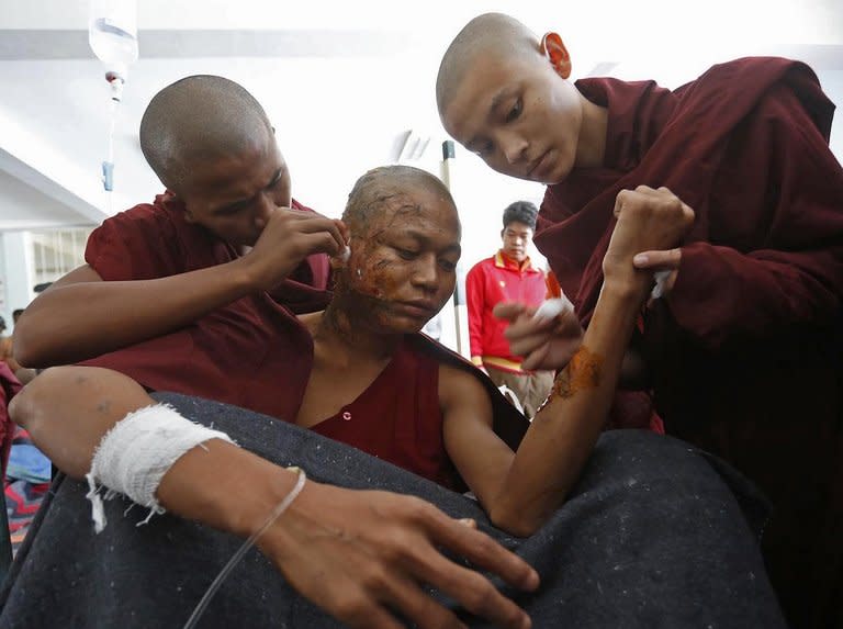 A seriously burnt Buddhist monk is seen receiving treatment at a hospital after police crackdown on a copper mine protest on villagers and monks protesting against the Chinese-backed mine, in Monywa, northern Myanmar, on November 29, 2012. The govt on Saturday dismissed an independent report that alleged security forces used white phosphorus in the crackdown which left dozens of people injured