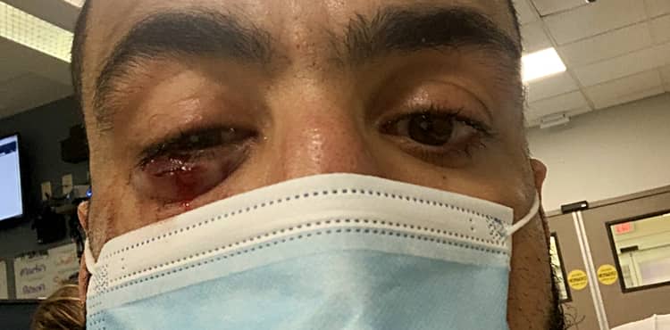 Belal Muhammad UFC Vegas 21 eye injury