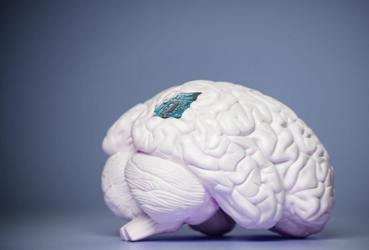 <a href="https://www.shutterstock.com/es/image-photo/bci-brain-computer-interface-chip-embedded-1997563814" rel="nofollow noopener" target="_blank" data-ylk="slk:Sergey Novikov/Shutterstock;elm:context_link;itc:0;sec:content-canvas" class="link ">Sergey Novikov/Shutterstock</a>