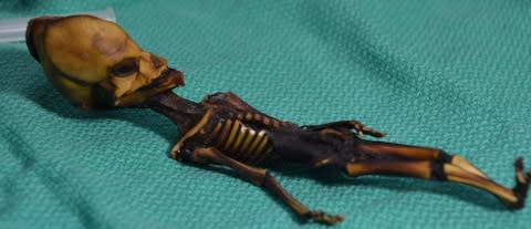 The skeleton had a mutation which caused its bones to grow abnormally and could one day help doctors heal fractures - Credit: Bhattacharya S et al. 2018. 