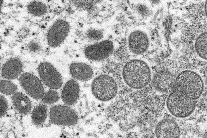Imagen de un microscopio electrónico proporcionada el miércoles 18 de mayo de 2022 por los Centros para el Control y la Prevención de Enfermedades (CDC) de Estados Unidos muestra viriones maduros de viruela del mono, de forma ovalada (izquierda) y viriones inmaduros esféricos (derecha), obtenidos de una muestra de piel humana asociada con un brote de 2003. (Cynthia S. Goldsmith, Russell Regner/CDC vía AP)