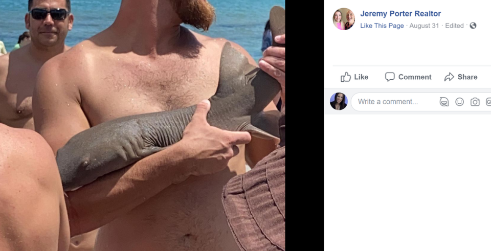 A beachgoer was bitten by a shark and it wouldn’t let go
