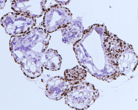 An immunohistochemical staining of trophoblast organoids for Ki67 is seen in this undated image handed out by the University of Cambridge, Britain. Margherita Turco/University of Cambridge/Handout via REUTERS