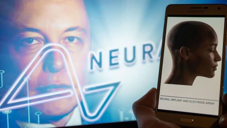 Neuralink es una compañía de neurotecnología especializada en el desarrollo de interfaces cerebro-computador.