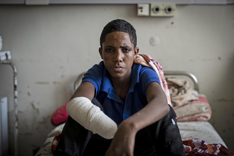 Haftom Gebretsadik, a 17-year-old from Freweini, Ethiopia, sits on his bed at the Ayder Referral Hospital in Mekele, in the Tigray region of northern Ethiopia, on May 6, 2021. He had his right hand amputated and lost fingers on his left after an artillery round struck his home in March, (Ben Curtis / AP file)