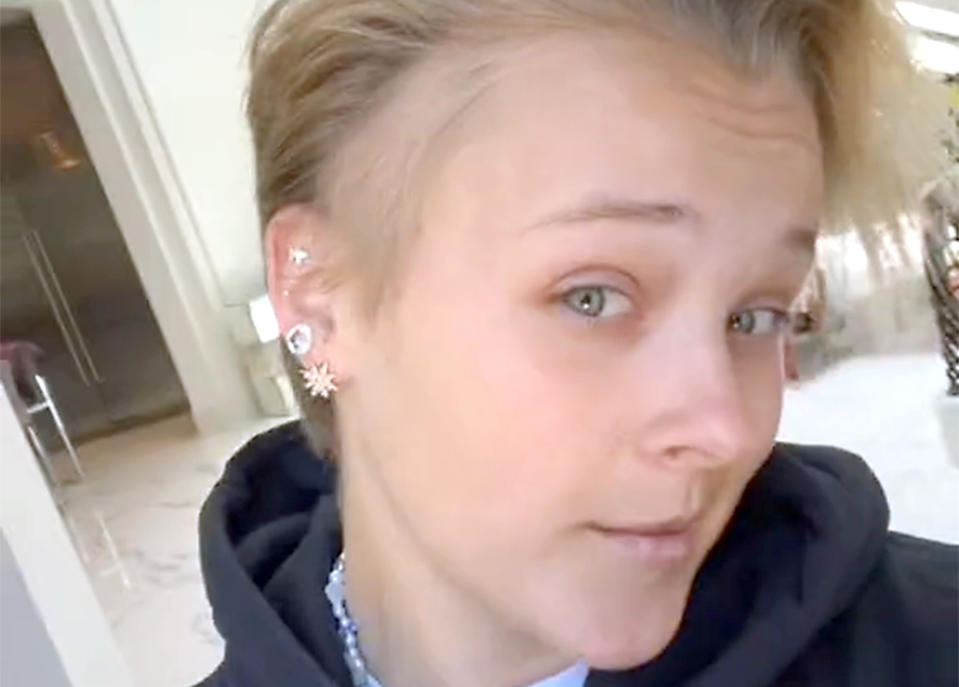 Siwa showed her fans an area of thinning hair on the right side of her head. (itsjojosiwa via TikTok)