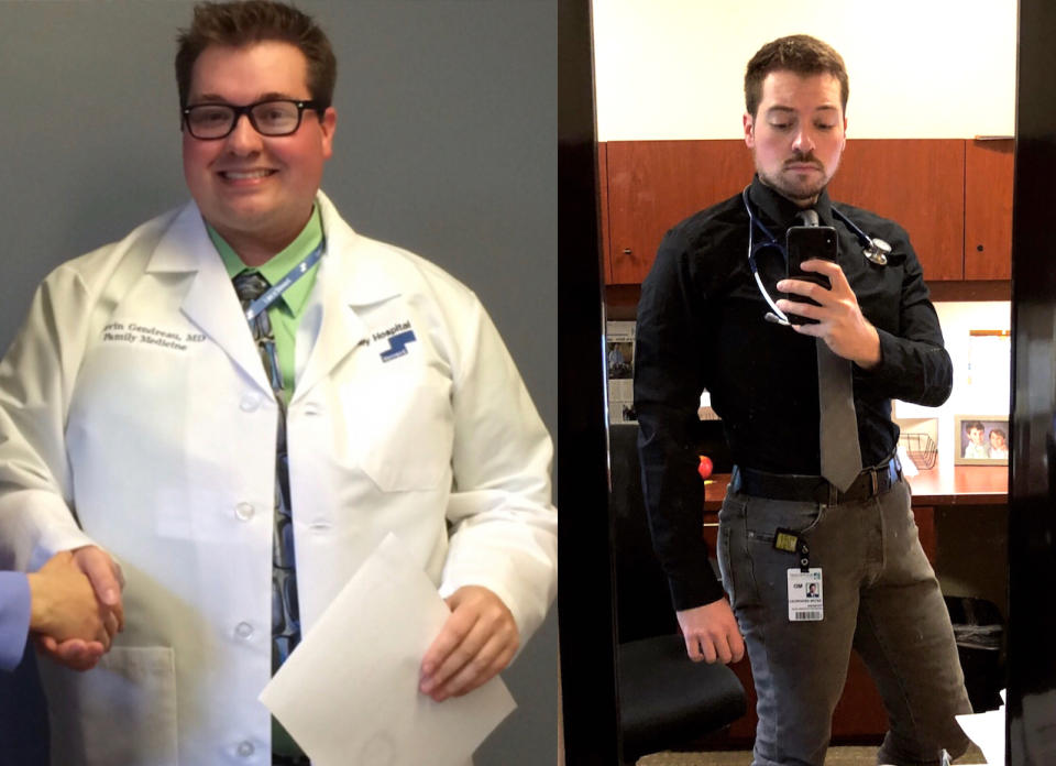 Kevin Gendreau, before and after. (Photos: Courtesy of Dr. Kevin Gendreau)