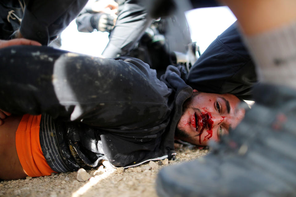 A man injured during clashes with Israel police in the Negev Desert