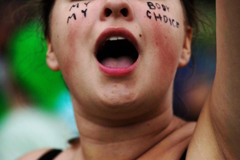 An abortion rights demonstrator shouts during a protest (Roberto Schmidt / AFP via Getty Images)