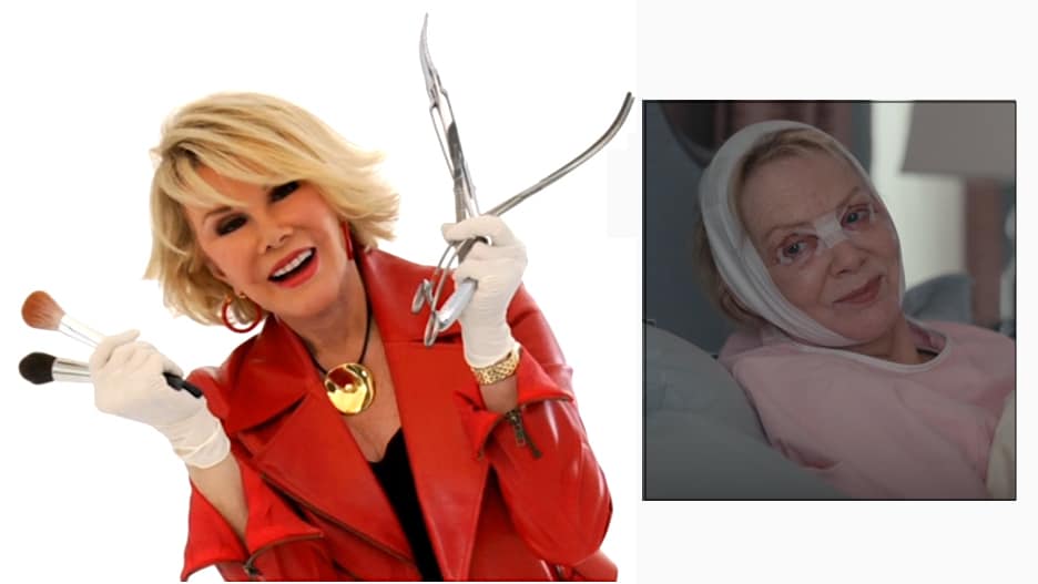 Joan Rivers plastic surgery