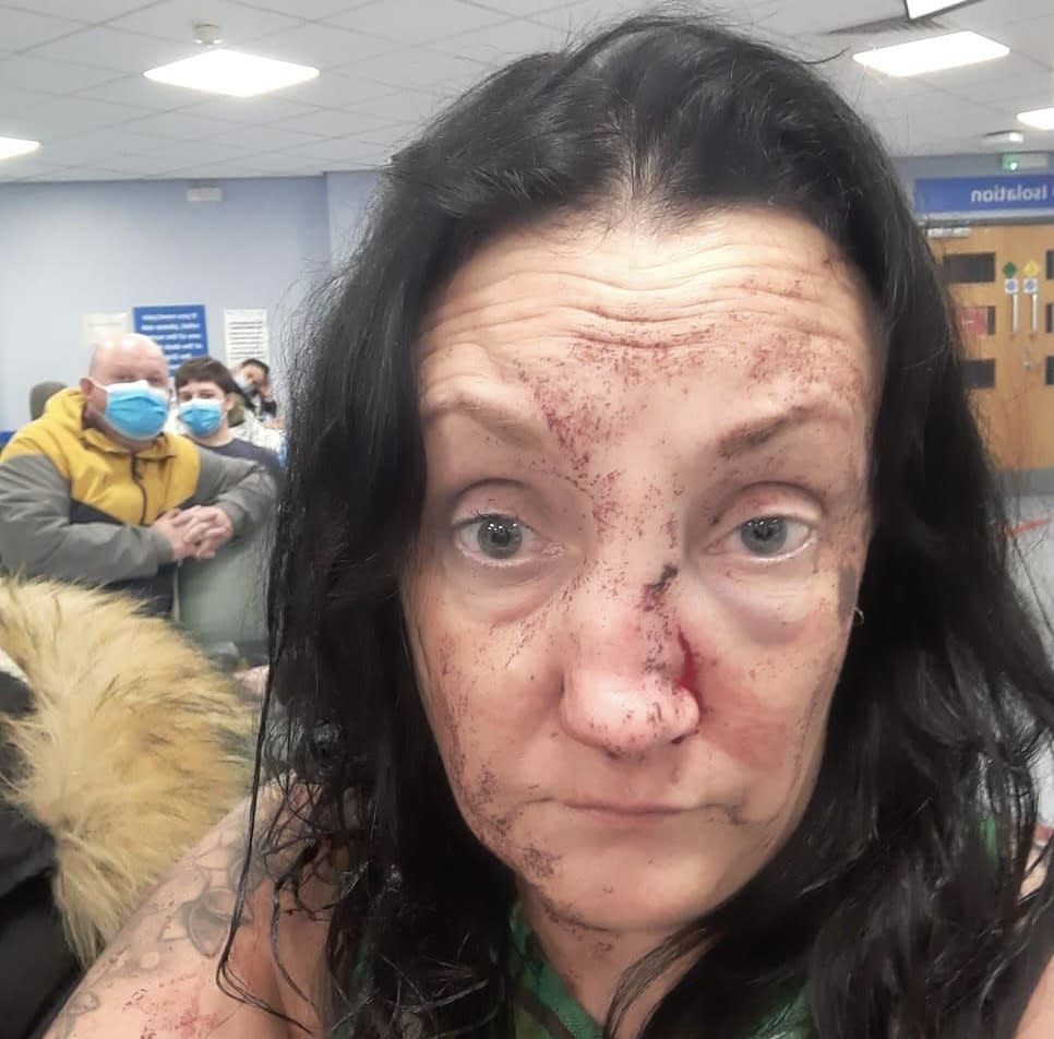 Bus driver Shelley was knocked unconscious in an unprovoked attack after a night out in Nottingham. (Reach)