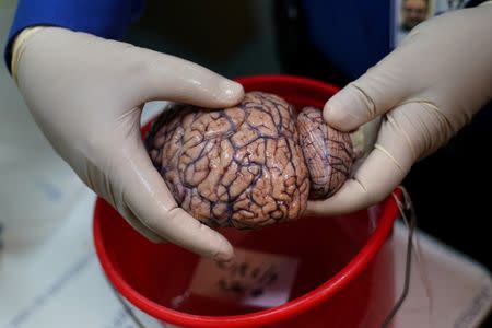Dr. Vahram Haroutunian holds a human brain in a brain bank in the Bronx borough of New York City, New York, U.S. June 28, 2017. REUTERS/Carlo Allegri