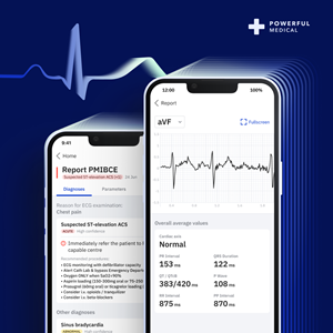 In the form of a smartphone application, the certified Class IIb medical device digitises and interprets any 12-lead ECG in under 5 seconds to provide accurate diagnoses and individualised treatment recommendations tailored to each patient.