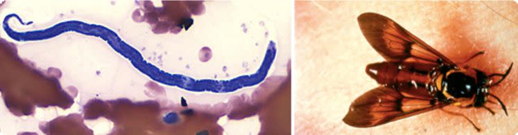 Left, a Loa loa microfilaria. Right, a deer fly. (Photo: <a href="https://www.cdc.gov/parasites/loiasis/" target="_blank">DPDx</a>)