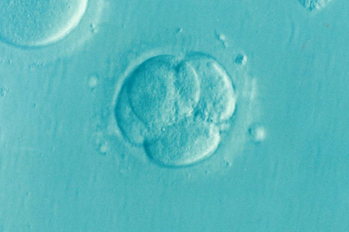 An egg during the IVF procedure (Elena Έλενα Kontogianni Κοντογιάννη/ Pixabay)