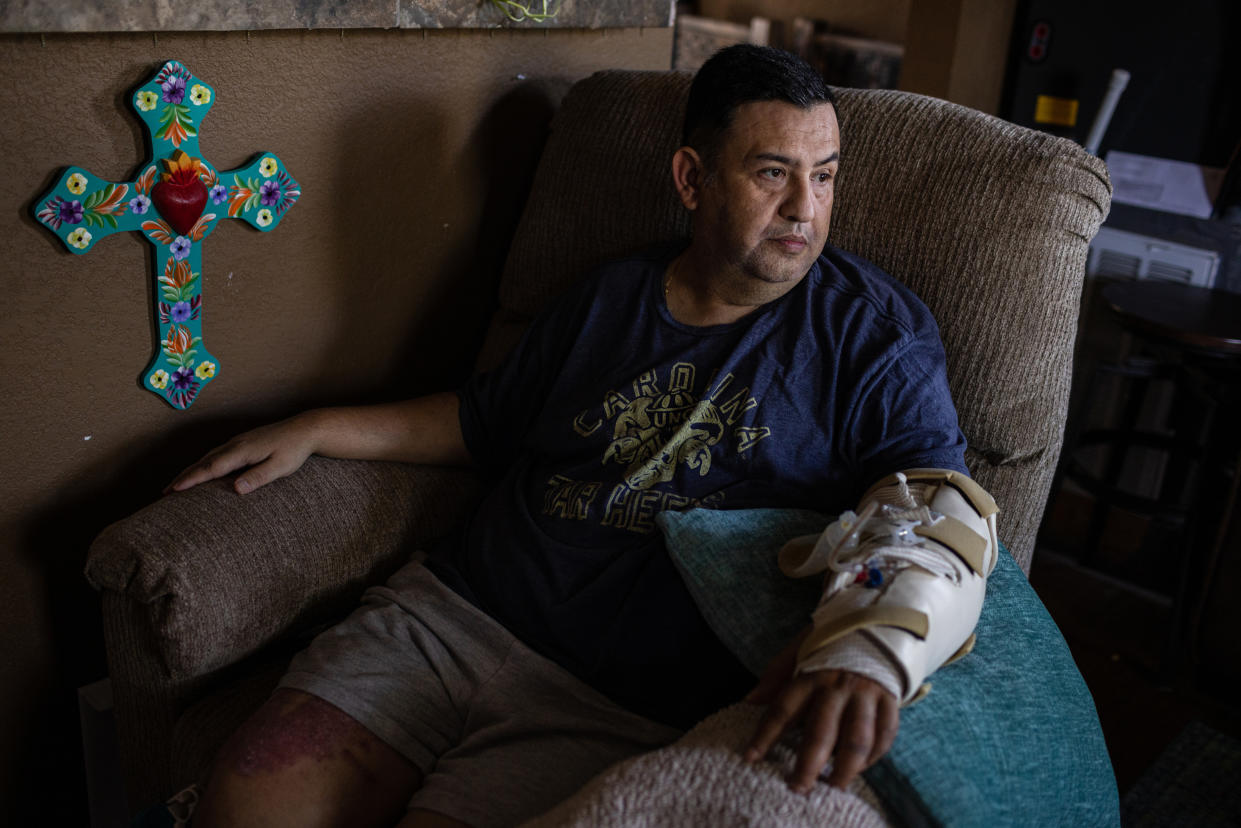 Arnulfo Reyes, un maestro que resultó herido en el tiroteo en la Escuela Primaria Robb, en su casa en Uvalde, Texas, el 9 de julio de 2022. (Tamir Kalifa/The New York Times)