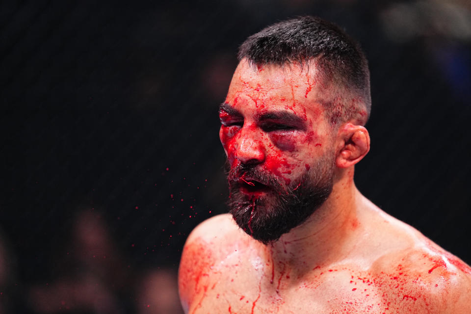 PARIS, FRANCE - SEPTEMBER 28: Benoit Saint Denis of France reacts after round two against Renato Moicano of Brazil in a lightweight fight during the UFC Fight Night event at The Accor Arena on September 28, 2024 in Paris, France.  (Photo by Chris Unger/Zuffa LLC)