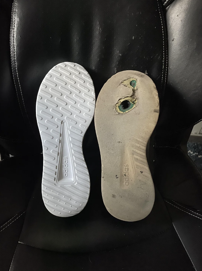 The 2-month-old shoe's sole is dirty beige and has a hole in it, while the new shoe is white
