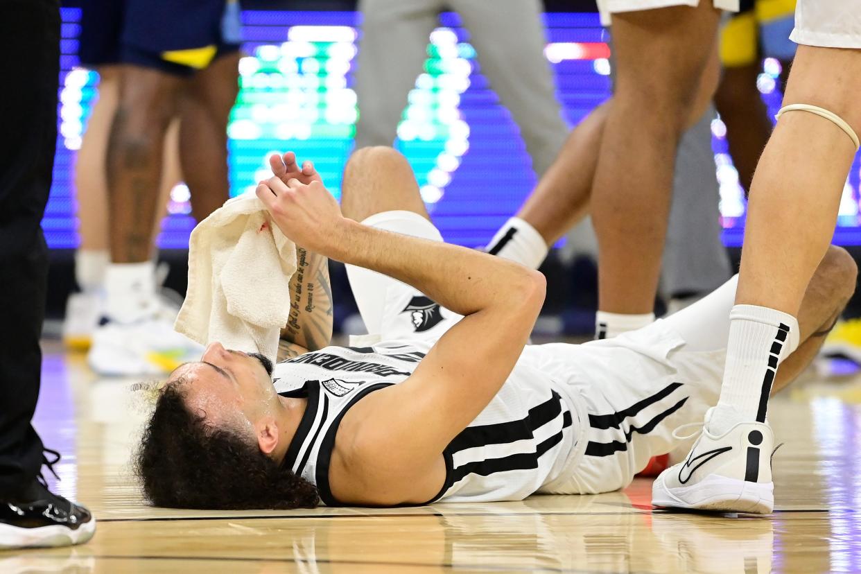 Dec 19, 2023; Providence, Rhode Island, USA; Providence Friars guard Devin Carter (22) wipes blood from his mouth during the first half against the Marquette Golden Eagles at Amica Mutual Pavilion. Mandatory Credit: Eric Canha-USA TODAY Sports