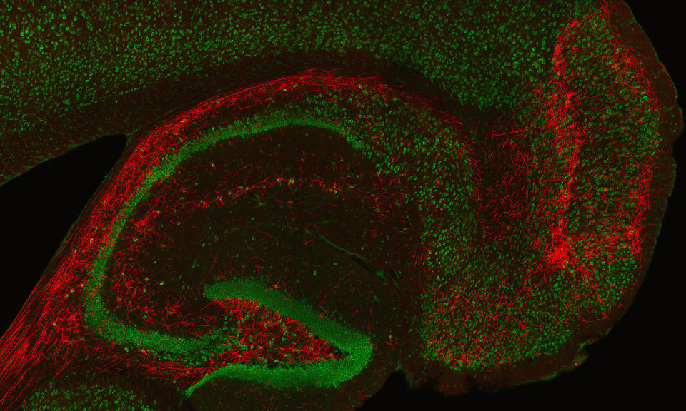 This is a close-up image of a particular area of the brain called the hippocampus, named from the Greek word for “seahorse” because of its shape. 