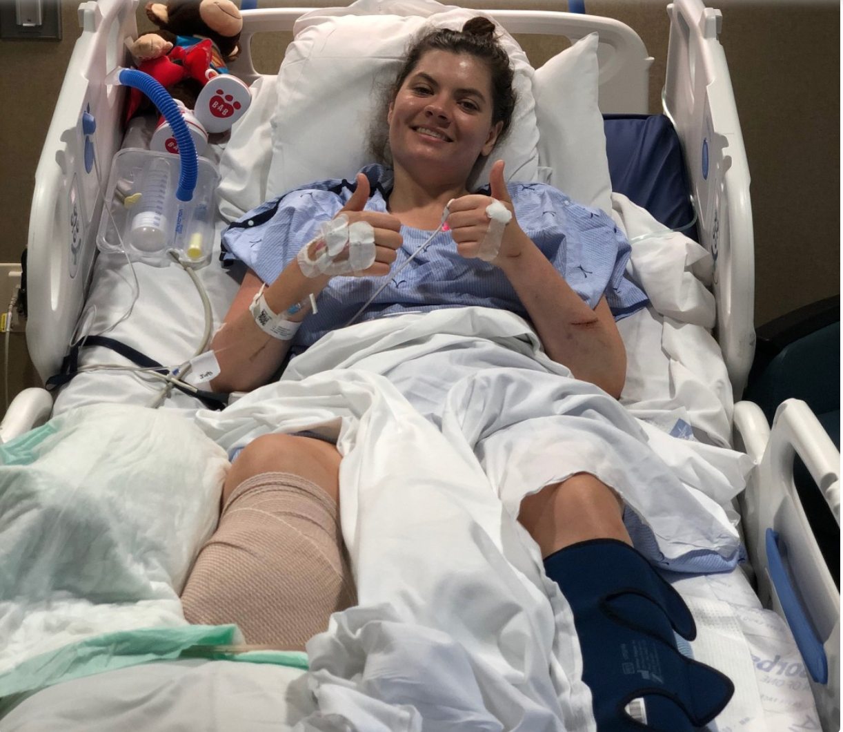 Leslie Burns, a high school English teacher, lost her leg in a boating accident on Lake Mead this week. (Photo Credit: KTNV)