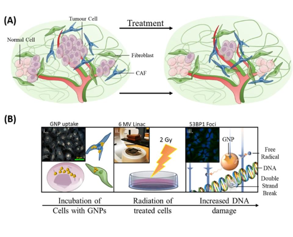 <div class="inline-image__caption"><p>Incorporating gold nanoparticles into current radiation treatment protocols had three goals: to enhance killing of tumor cells, to target CAFs and to protect fibroblasts.</p></div> <div class="inline-image__credit">Bromma et al.(2020), Sci Reports, 10, 2181)/The Conversation</div>