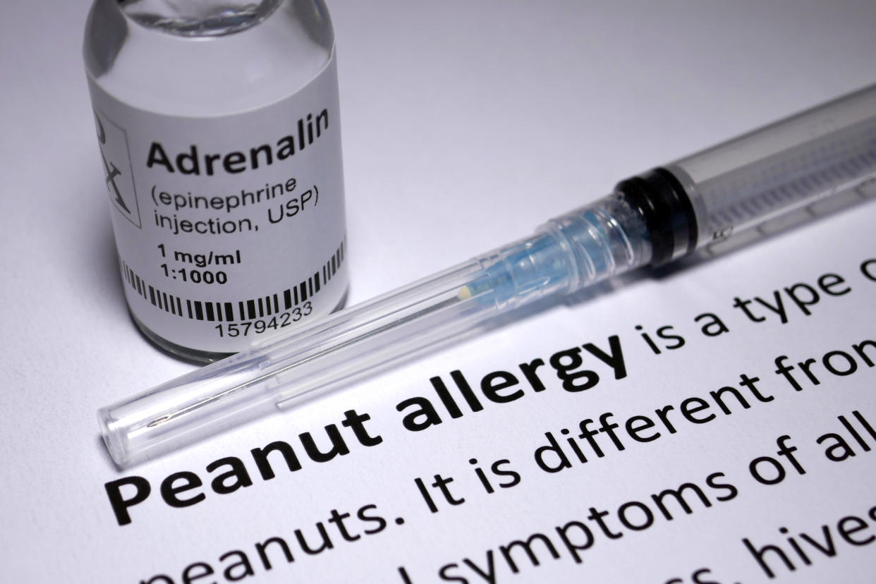 Peanut Allergy - one of many common allergies.