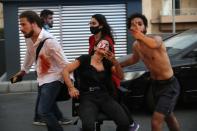 Wounded people are pictured outside a hospital following an explosion in the Lebanese capital Beirut on August 4, 2020. - Two huge explosion rocked the Lebanese capital Beirut, wounding dozens of people, shaking buildings and sending huge plumes of smoke billowing into the sky. Lebanese media carried images of people trapped under rubble, some bloodied, after the massive explosions, the cause of which was not immediately known. (Photo by IBRAHIM AMRO / AFP) (Photo by IBRAHIM AMRO/AFP via Getty Images)