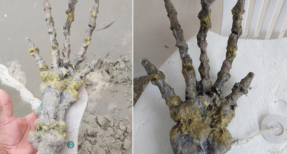 A bony hand with long fingers is found on a beach in Brazil.