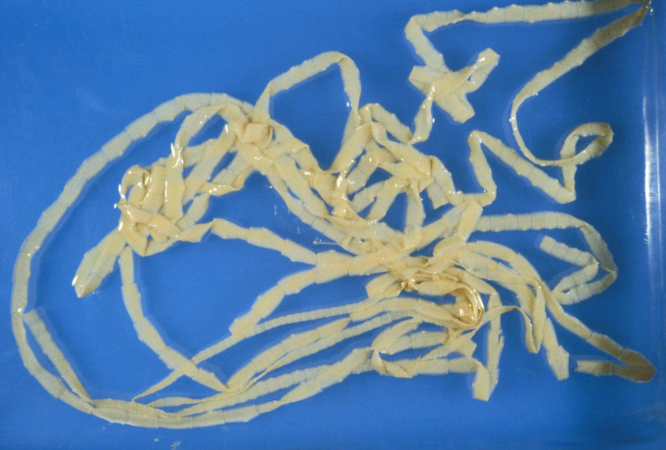 Beef tapeworm (Taenia saginata), a parasite of both cattle and humans, where it causes the disease taeniasis. This specimen was 10 meters long when untangled. (Photo: Science Source/Getty Images)