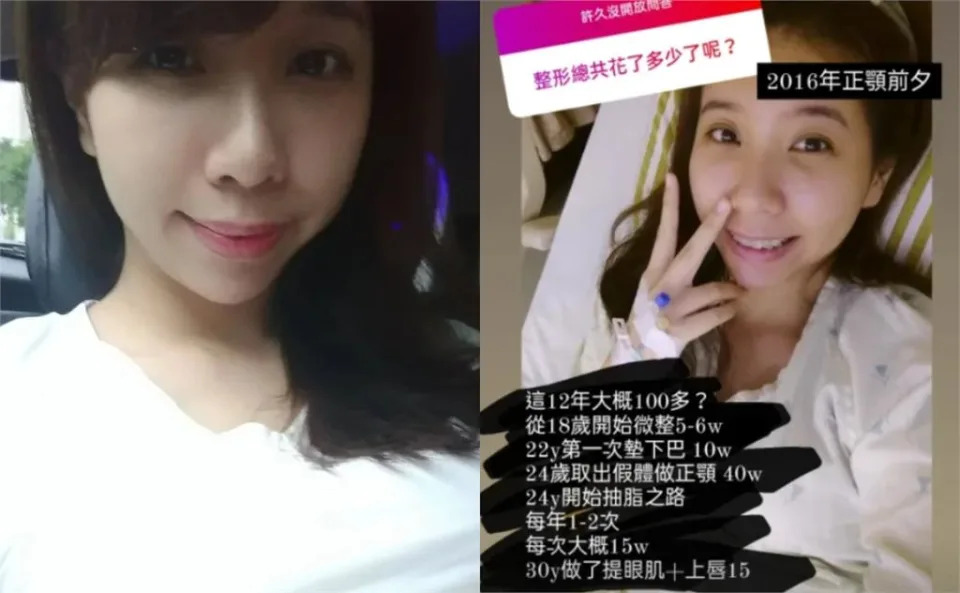 台灣最頂女優「10年臉蛋進化史」！砸百萬動刀「18歲就微整」網震撼：值得…