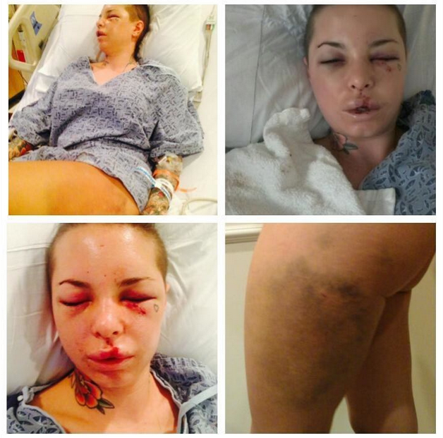 Mack shared photos after the attack on social media.