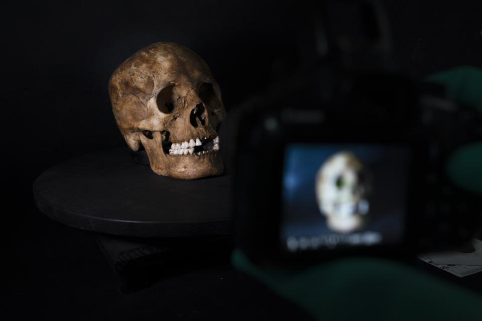 A skull sits on a shelf at the forensics lab in Ciudad Victoria, Mexico, Friday, Feb. 4, 2022. The official total of Mexico’s missing is nearly 100,000. Even without the civil wars or military dictatorships that afflicted other Latin American countries, Mexico’s disappeared are exceeded in the region only by war-torn Colombia. (AP Photo/Marco Ugarte)