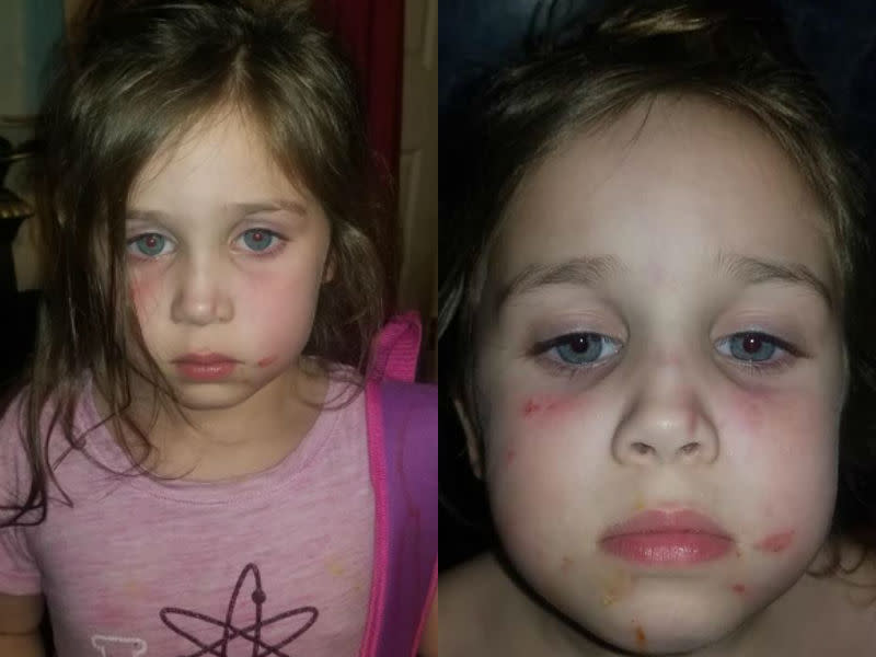 Briellea Gamez, 5, was attacked on the school bus. (Photos: Courtesy of Aubrey Corley)