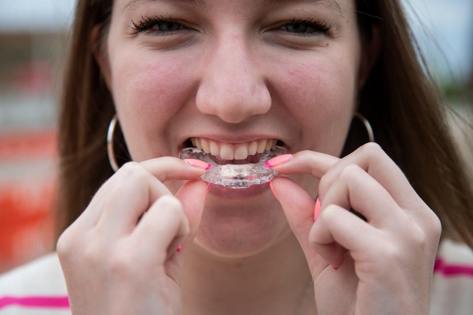 Sarah Stovall, 20, of Grosse Pointe, shows how she puts on her dental guard in Detroit on Saturday, Aug. 13, 2022.