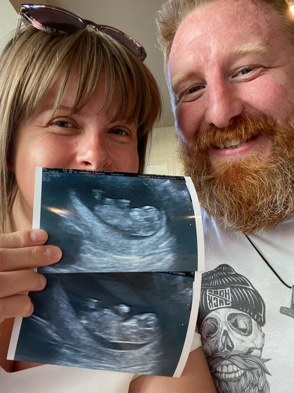 Jennifer and Matthew discovered they were expecting in June 2022. (Jennifer Blandford/Caters)