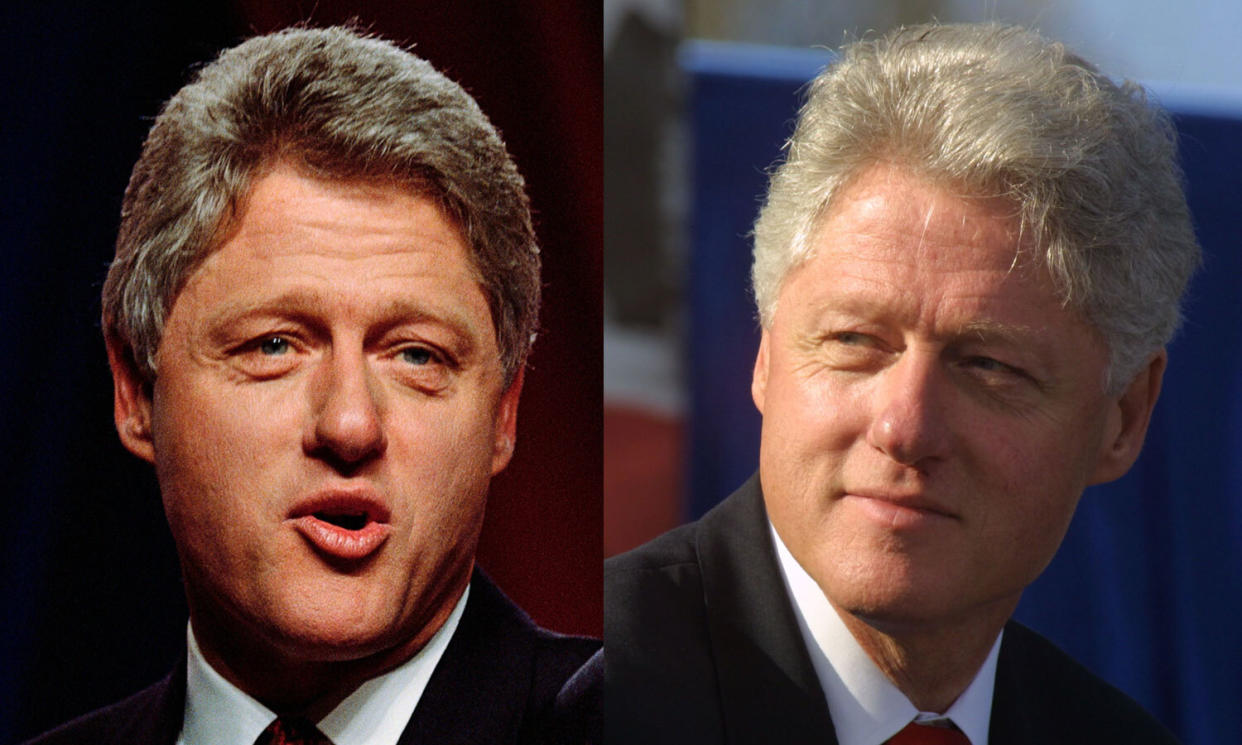 President Clinton's gray hair turned white during his terms in office. Depicted in 1992 and 2000. (Photos: Getty Images)