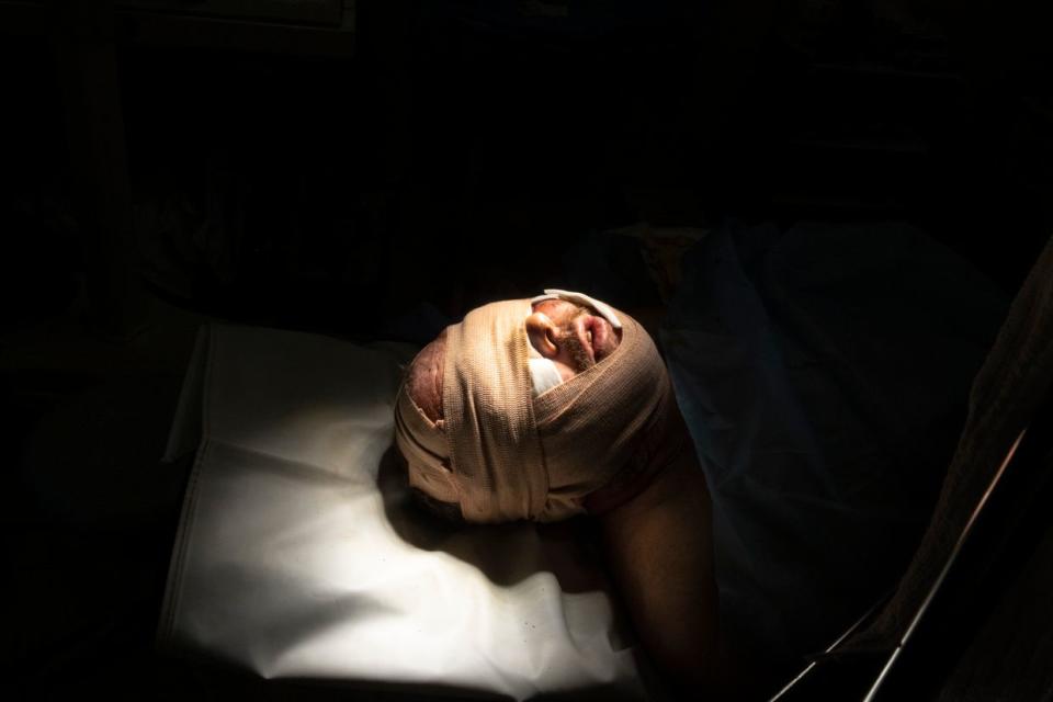 A soldier with serious head and eye wounds is seen after an operation at a hospital where the military are treated in Donetsk Oblast, Ukraine, on Oct. 8, 2022. (Paula Bronstein/Getty Images)