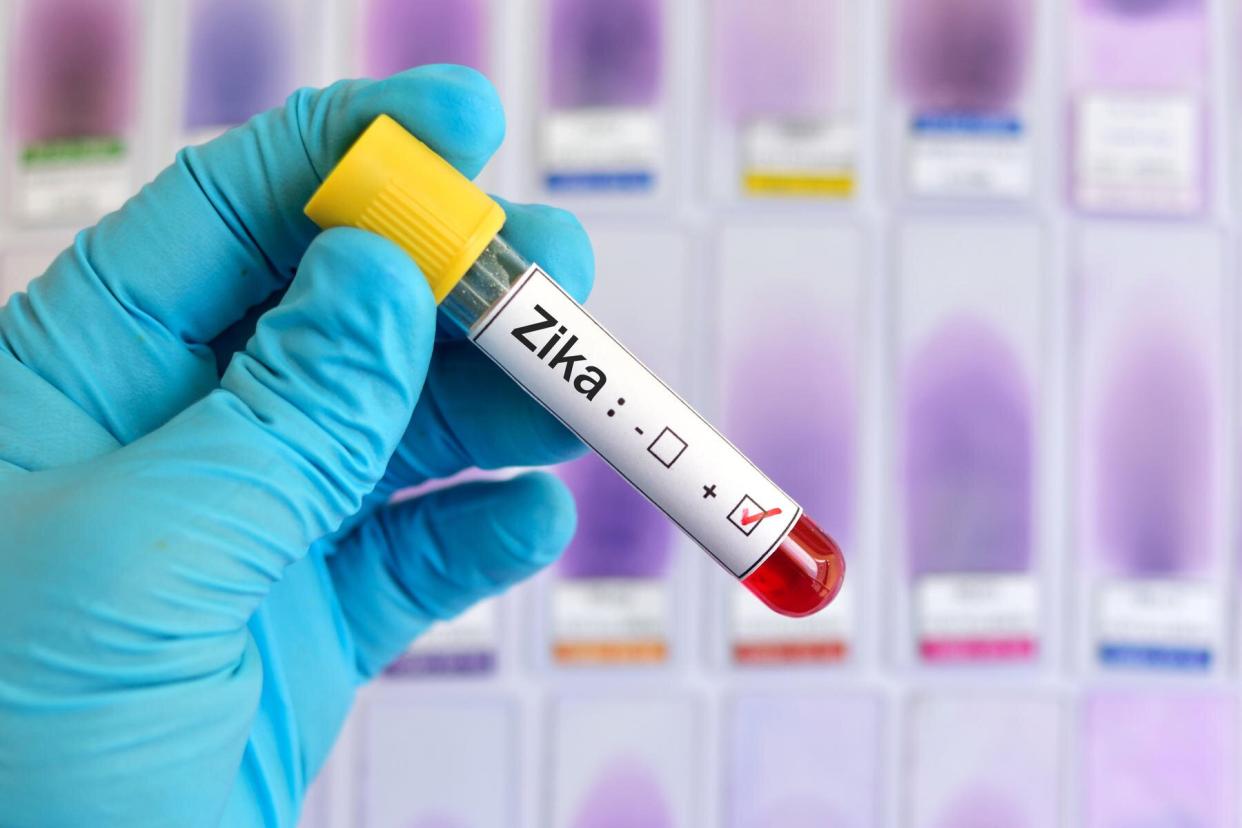 Zika Virus test tube