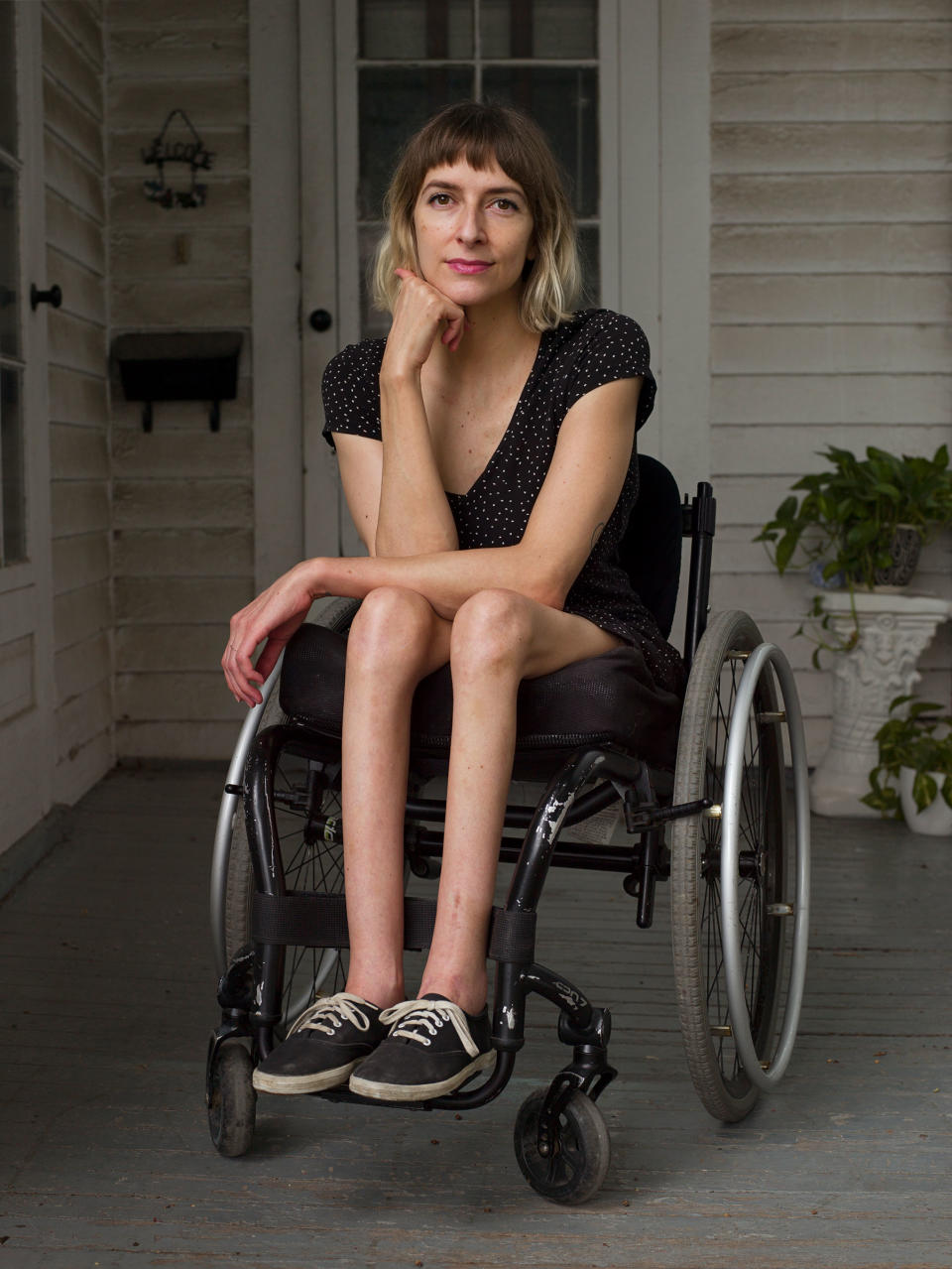 <strong>Rebekah Taussig</strong>, photographed outside her home in Kansas City, Mo., on Aug. 6. "<a href="https://time.com/5881597/disability-kindness/" rel="nofollow noopener" target="_blank" data-ylk="slk:What Does Kindness Look Like?;elm:context_link;itc:0;sec:content-canvas" class="link ">What Does Kindness Look Like?</a>" Aug. 31 issue.<span class="copyright">Jess Dugan for TIME</span>