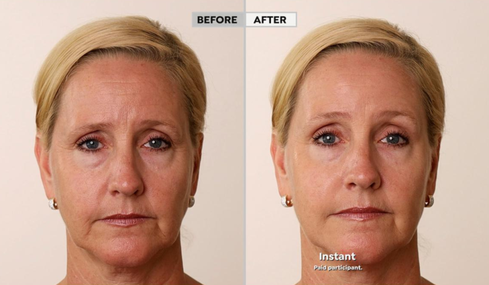 Shoppers say it reduces the appearance of wrinkles. (Photo: HSN)