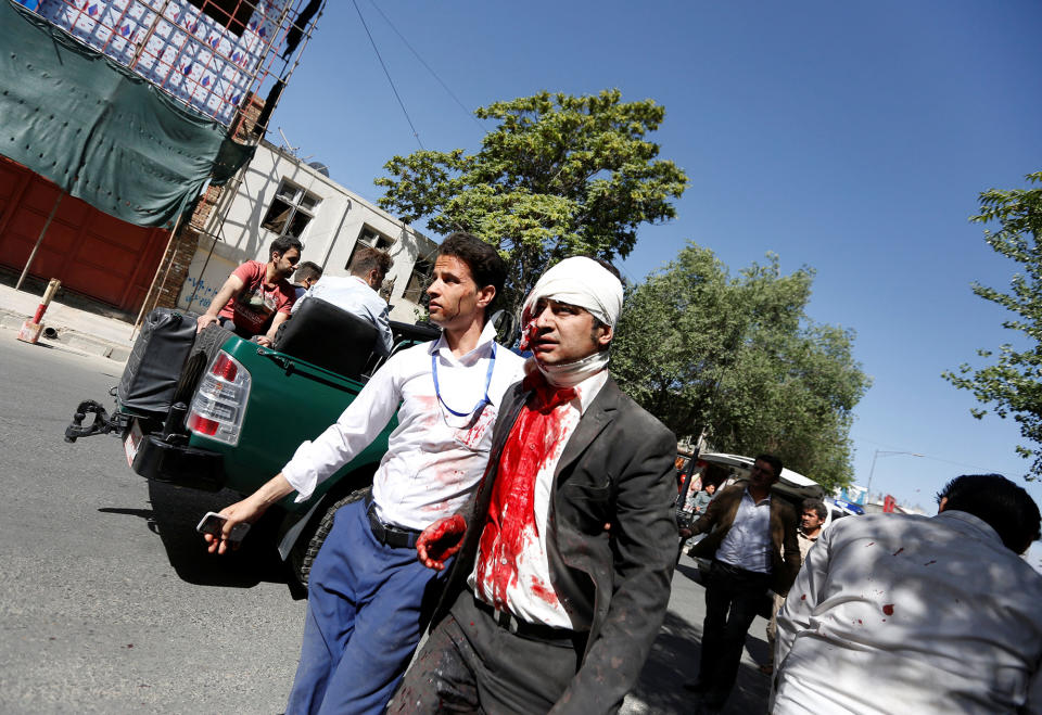 <p>An injured man arrives to a hospital after a blast in Kabul, Afghanistan May 31, 2017. (Mohammad Ismail/Reuters) </p>