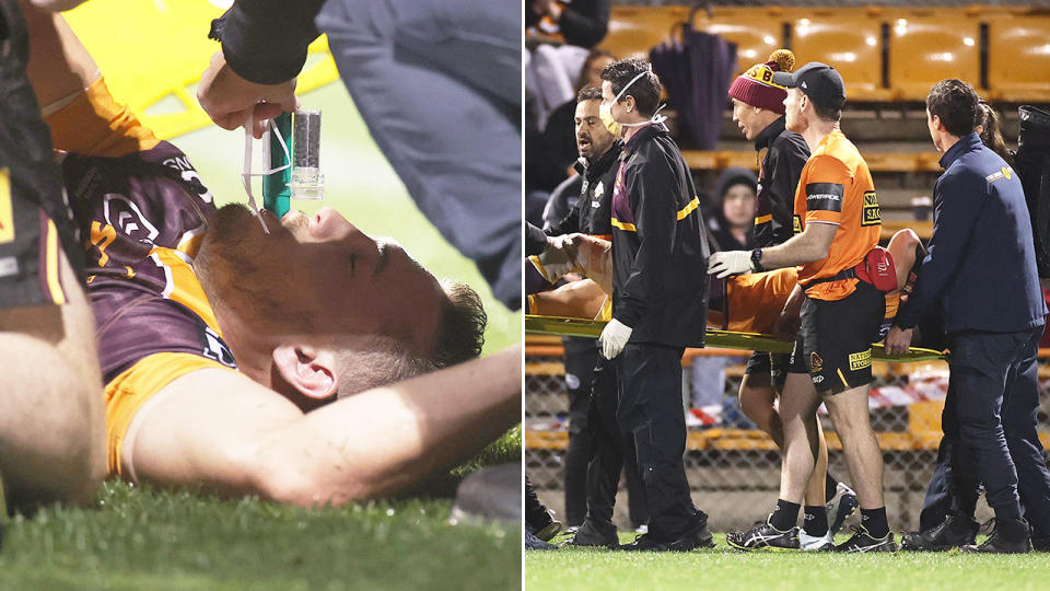 Seen here, Corey Oates is taken from the field after suffering a leg fracture.