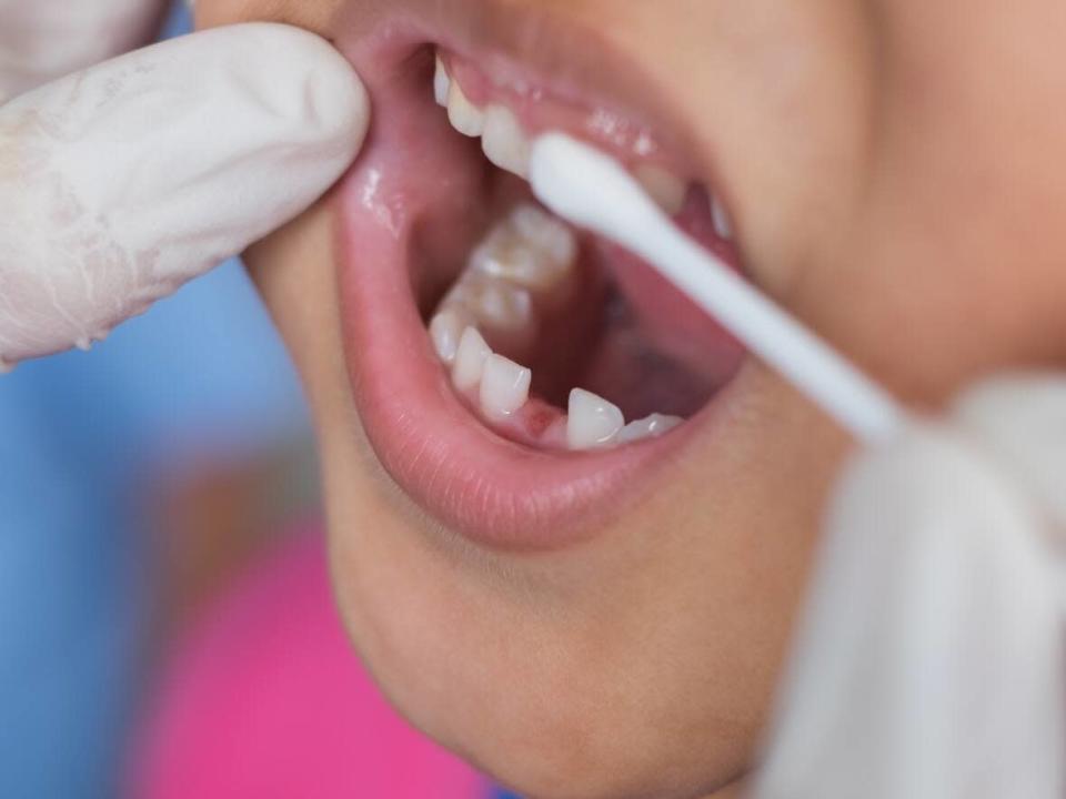 The new Liberal-NDP agreement has resulted in a proposal to create a national dental care program for low-income Canadians which would be the largest expansion of Canada&#39;s public health-care system in decades. (Shutterstock / chanchai plongern - image credit)