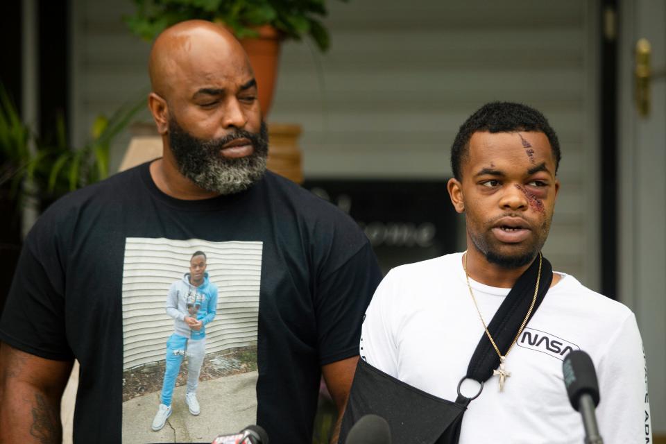 DarQuan Jones speaks at a news conference next to his father, Daryl Jones Jr., in Des Moines, Iowa. Jones, 22, was assaulted by white men May 16 in a racially motivated attack, resulting in five facial fractures and a broken wrist. Jones said there was an attempt to drown him in a nearby creek, and at least one perpetrator repeatedly used racial slurs. As of Friday, June 19, 2020,, one suspect has been arrested and one additional warrant issued for arrest.